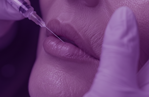 Dermal Filler